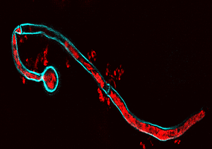 Candida albicans