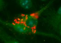Legionella pneumophila bacteria