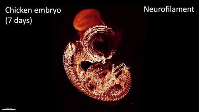 Chicken Embryo Neurofilaments