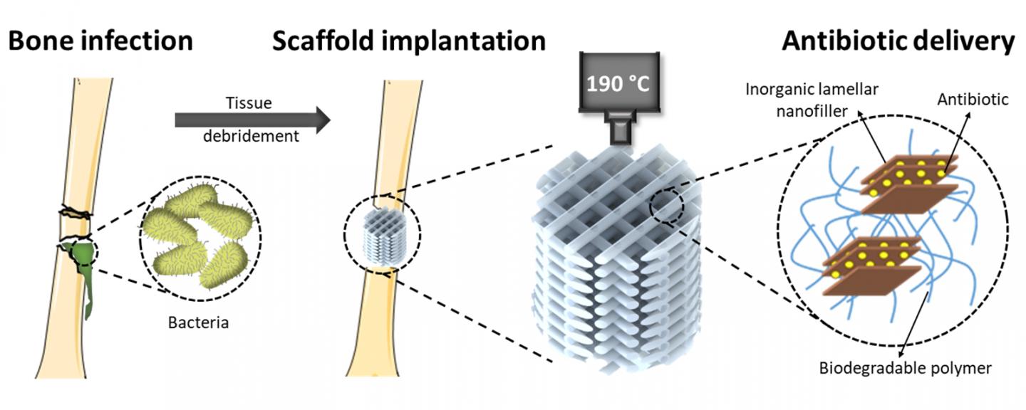 How the antibiotic-emitting 3D printed scaffolds work.