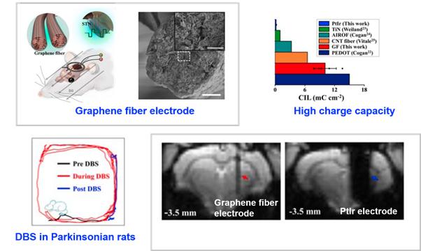 High MRI Compatibility