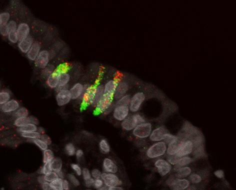 Rare cell type in the small intestine