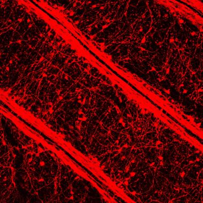 Nervous System Transgenicpolyp