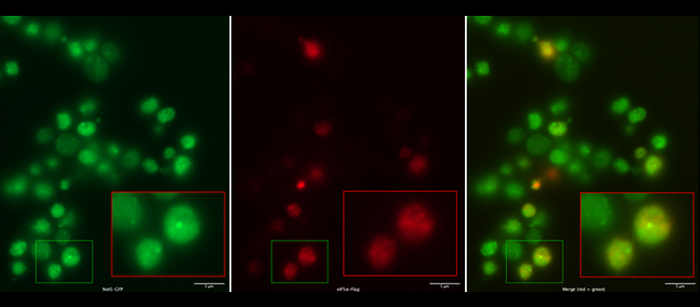 How to produce proteins at the right speed
