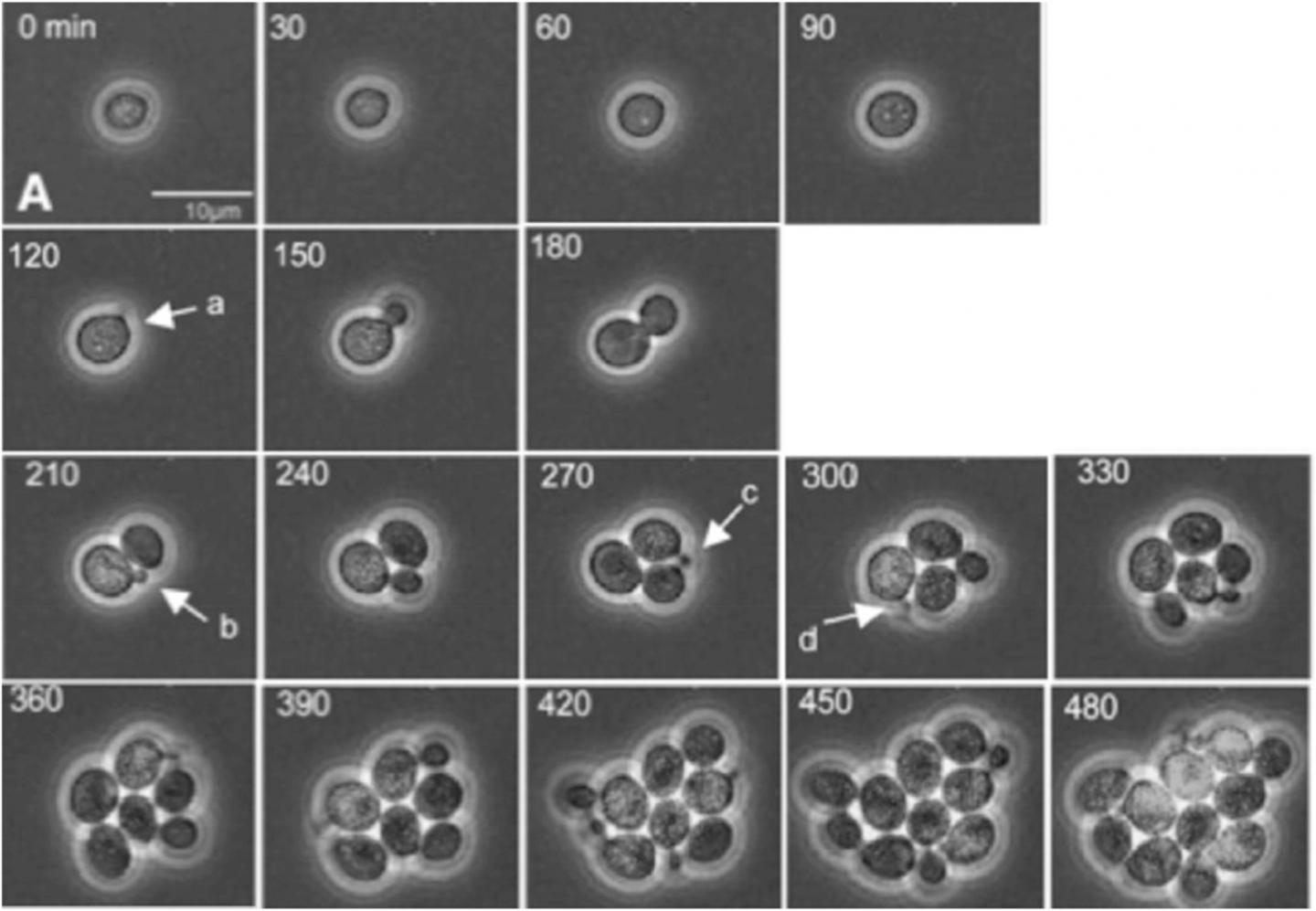 the-physics-behind-tumor-growth-eurekalert