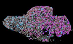 The superior cervical ganglion of a mouse: Here, neurons that control the heart muscle (pink) are in close proximity to those that control the pineal gland (blue).