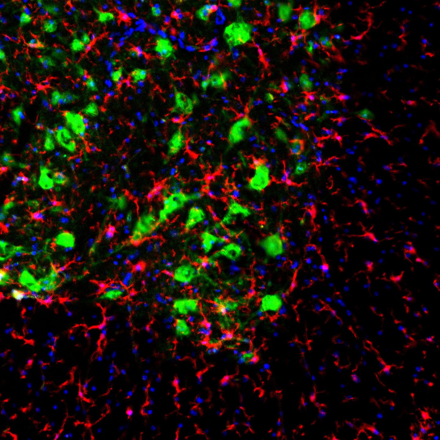 Spinal cord of mutant SOD1 mouse showing motor neurons in green and activated microglia in red.