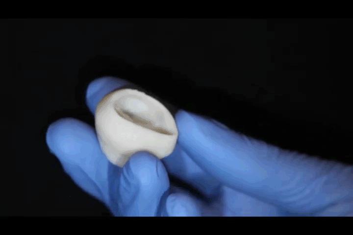 Trileaf Heart Valve Bioprinted in Collagen