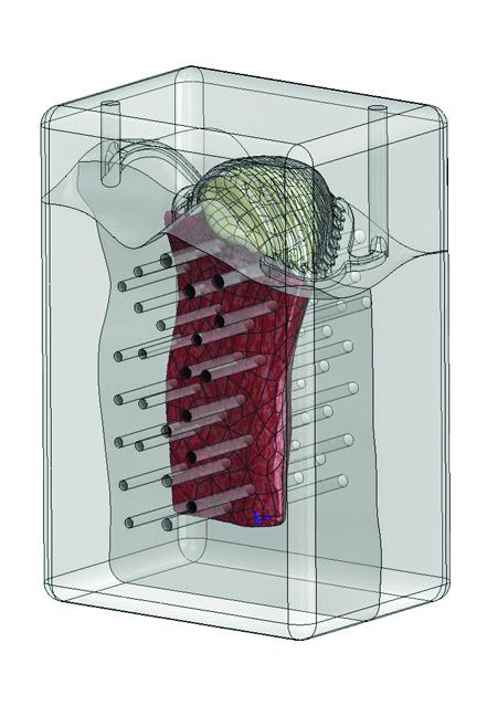 Tissue Grafts of Both Bone and Cartilage Could Regenerate Damage to a Crucial Jaw Joint (1 of 9)