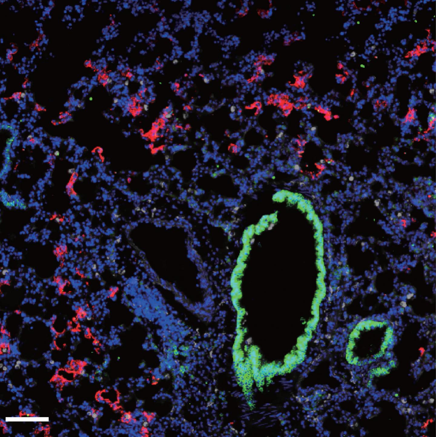 Infects the Lungs of Mice Expressing Human ACE2