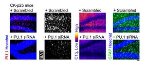 Nanoparticle-delivered RNA reduces neuroinfla - Vimarsana News