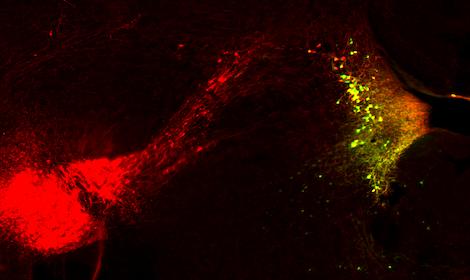 Norepinephrine Release in the Mouse Brain