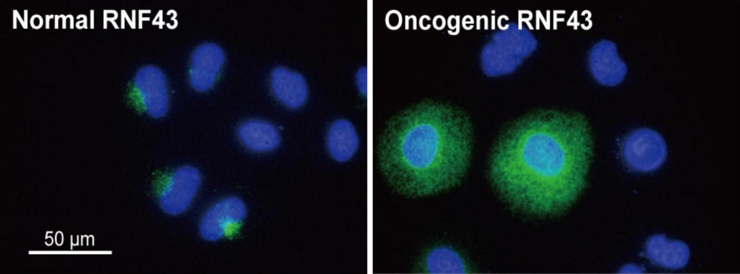 Expression of Normal and Oncogenic RNF43 in Cells