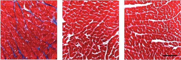 Fighting Age-Related Fibrosis to Keep Organs Young