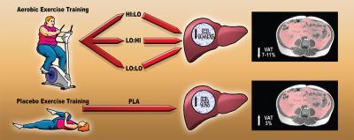 New Study Indicates that Exercise Improves Non-Alcoholic Fatty Liver Disease