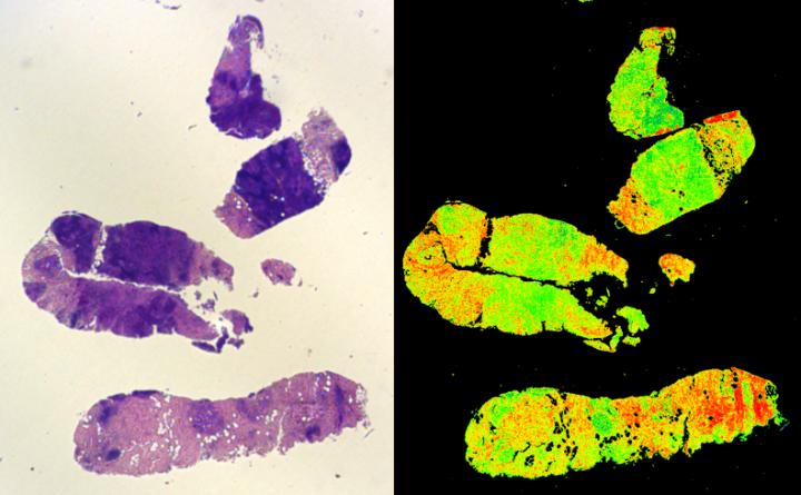 Comparison Biopsies