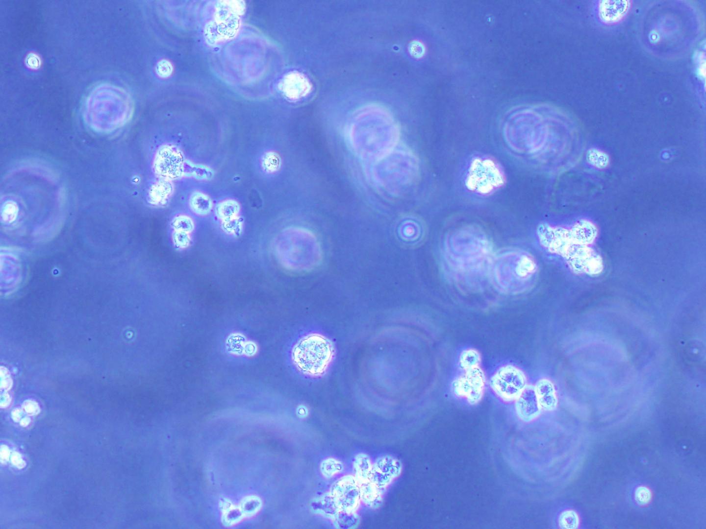 Cancer Cells After Treatment