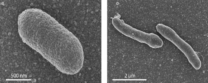 Shape of Normal and Engineered <i>E. coli</i>