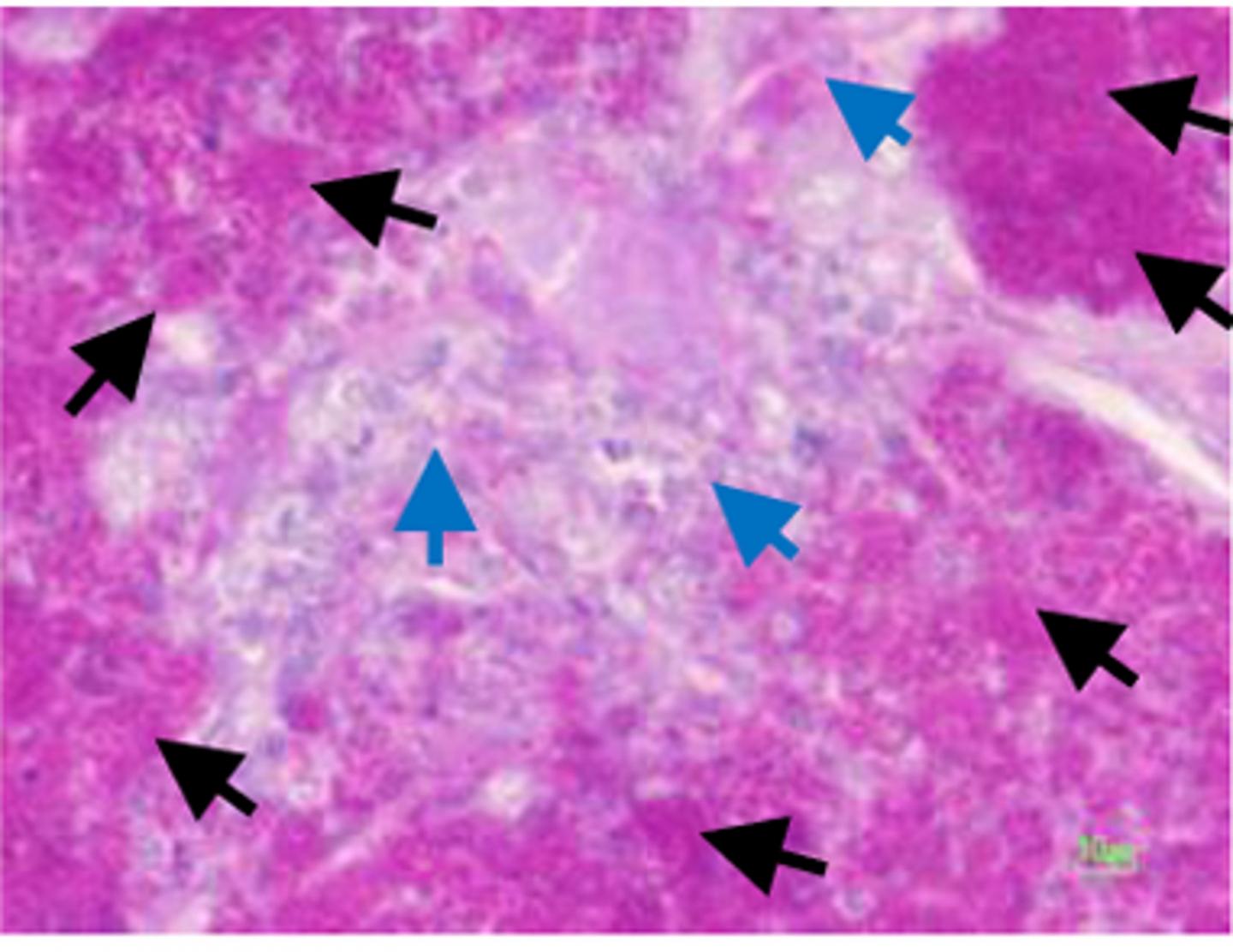 Fighting Penicilliosis