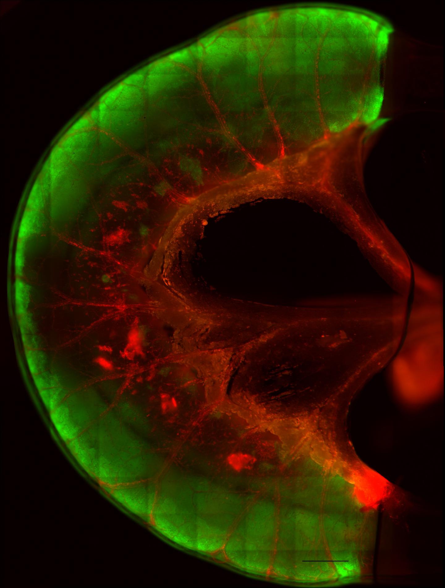 Small Bowel Segment Repopulated with Human Cells