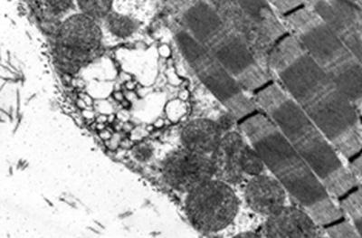 Muscle Expressing Mutated VCP