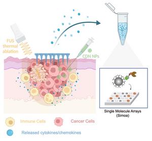 Microneedles and ultra-sensitive biomarker analysis in melanoma