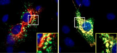 Cells Accumulate BACE1