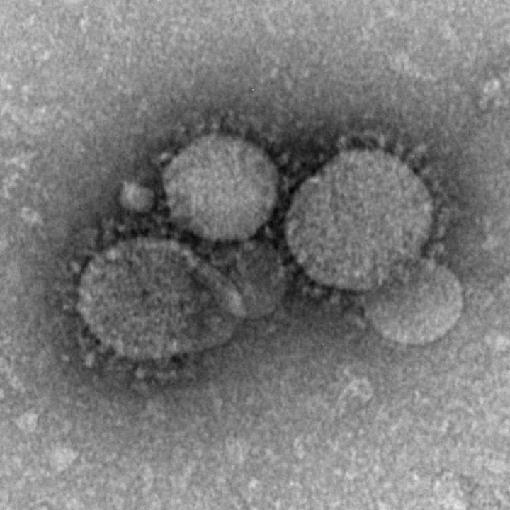 Electron Microscope Image of the MERS Coronavirus