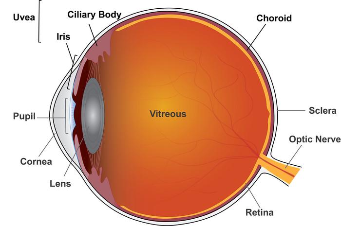 Uveitis schematic