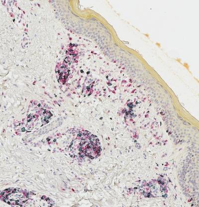 Resident Memory T Cells