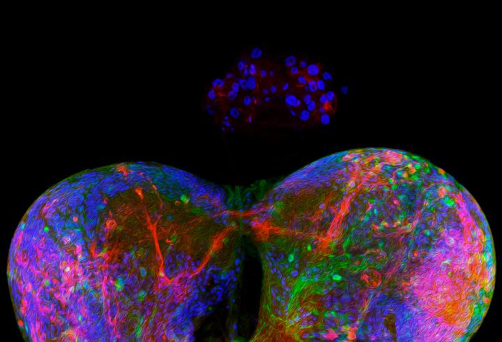 Drosophila's brain exhibiting the ring gland.