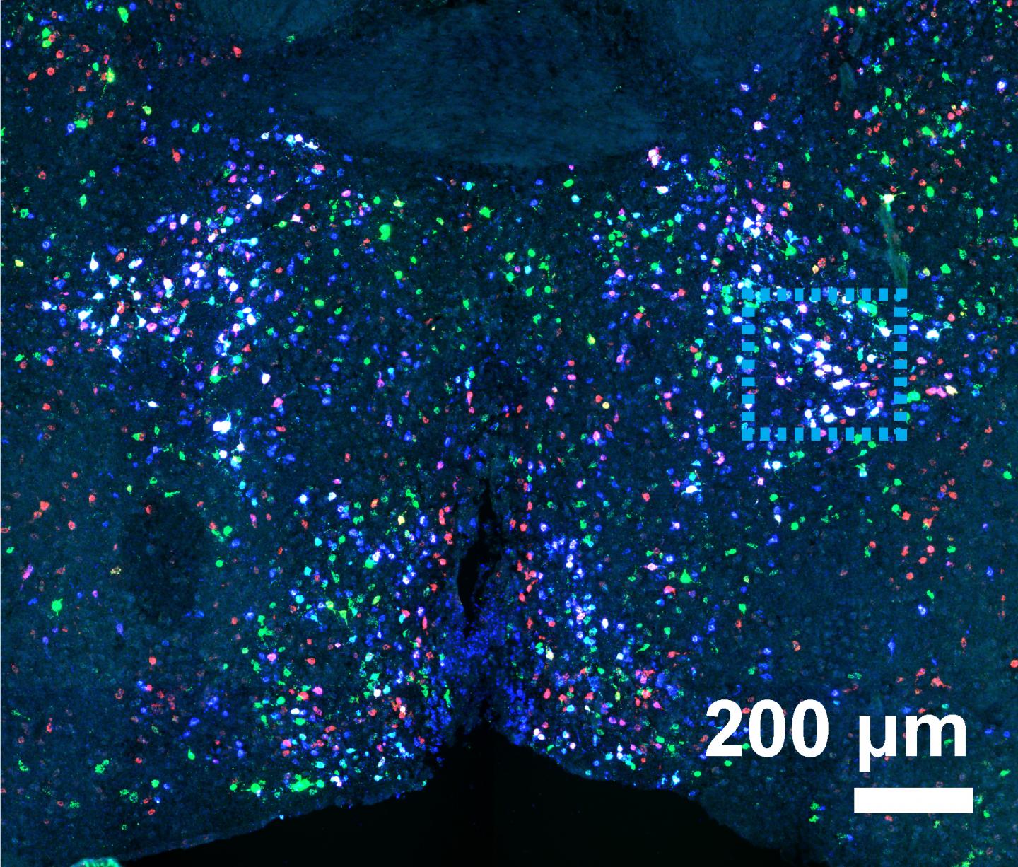 Neuronal Clusters in Virgin Female Mouse Preoptic Region