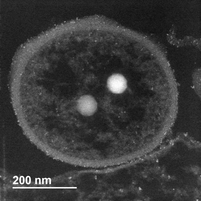 Deep-sea vent bacteria with granules