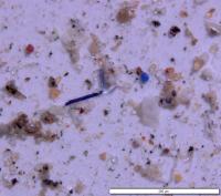 Magnified View of Microplastics and Other Particles Collected in Protected Areas