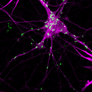 Shining a light on protein aggregation in Parkinson's disease - EurekAlert