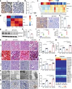 G protein-coupled receptor 107 deficiency promotes development of diabetic nephropathy