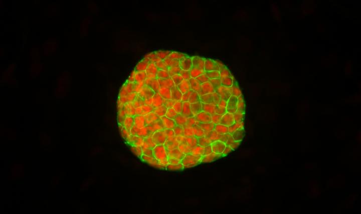 Colony of iPS Cells (1 of 3)