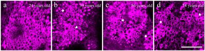 Basal Keratinocytes