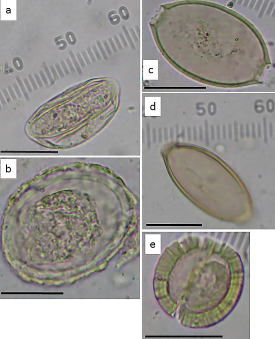 Intestinal parasite eggs recovered from sediment collected below the stone toilet seat at Armon Hanatziv