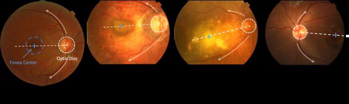 Identifying anatomical structures at the back of the eye