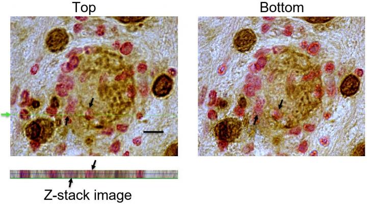 New Evidence Shows Cytotoxic T Cells Can Identify, Invade, and Destroy Targets of Large Cysts