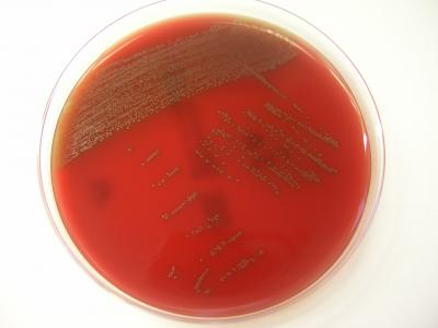 Colonies of <i>S. tigurinus</i> on Sheep Blood Agar