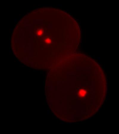 2 Pollen Grains Wiewed by Fluorescence Microscopy