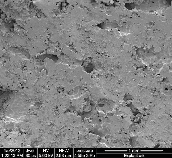 PMMA Space Maintainer