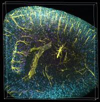 Vasculature, Glia Cells, and Plaques in the Brain