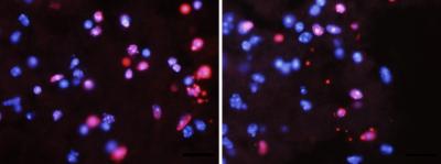 Salk Scientist Discovers Novel Mechanism in Spinal Cord Injury