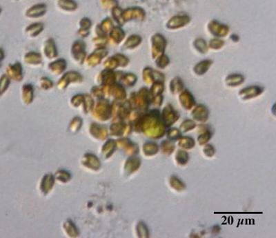 <i>Prymnesium</i> Algae Attacking a Green Alga