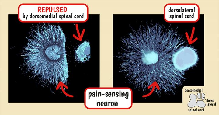 Nociceptive Neurons Repelled by Dorsomedial Spinal Cord