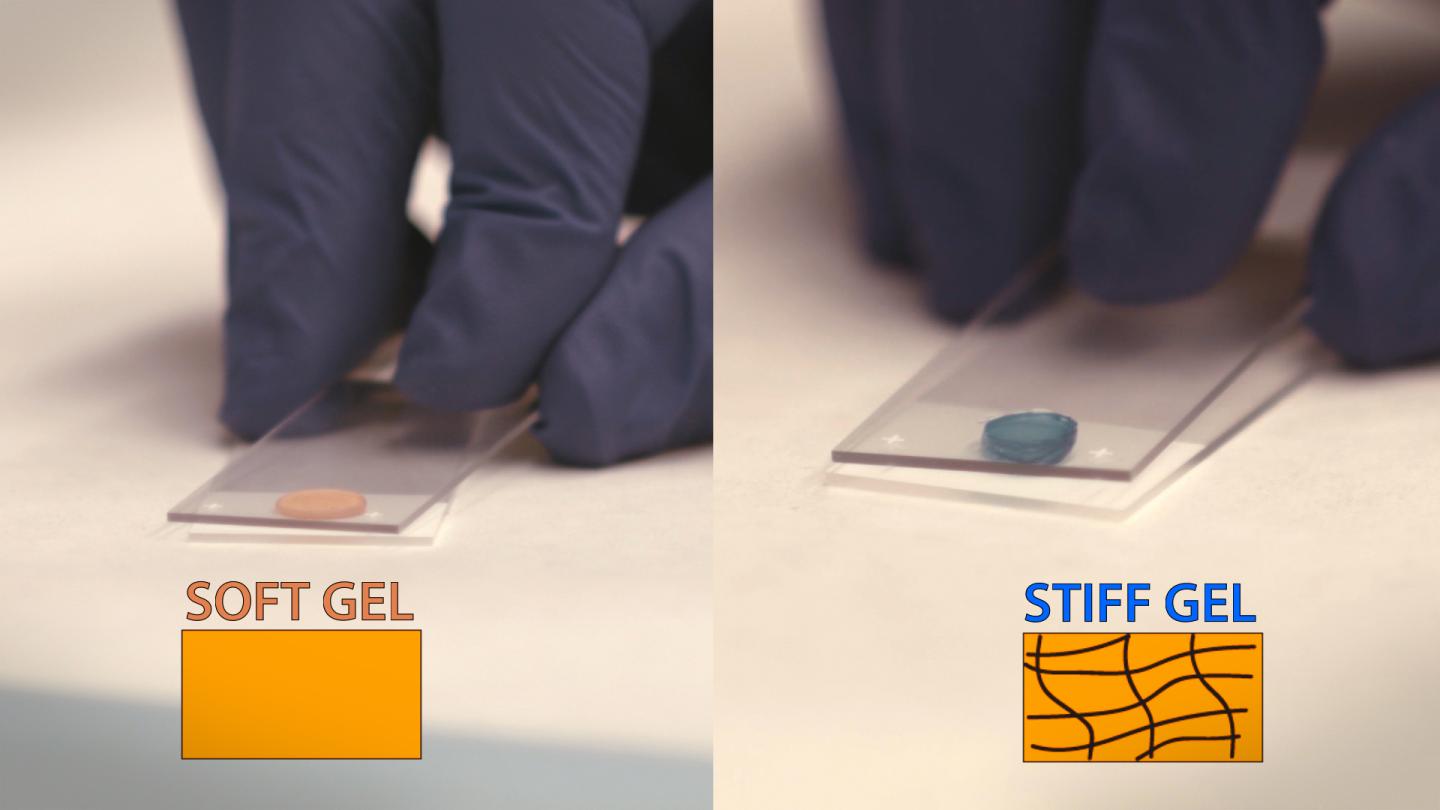 After the Heart Attack: Injectable Gels Could Prevent Future Heart Failure (Video)