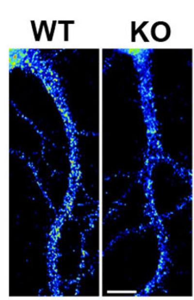 Levels of Kv4.2 Protein in Brain Cells